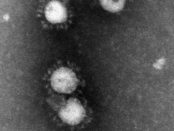virus-coronovirus-high-resolution